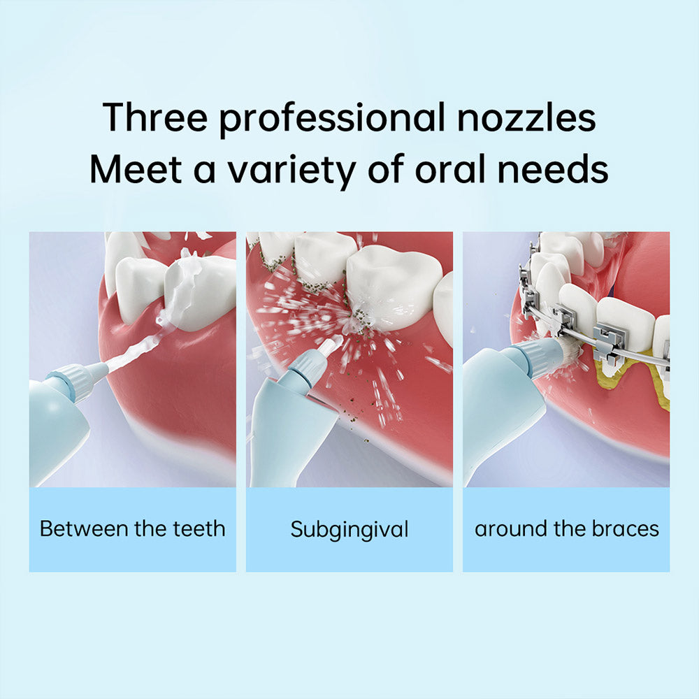 SUNUO C3 PRO Smart Visual Oral Irrigator Dental Washer with UV Sterilization, 5MP HD Camera, WiFi Connection, IPX7 Waterproof - White