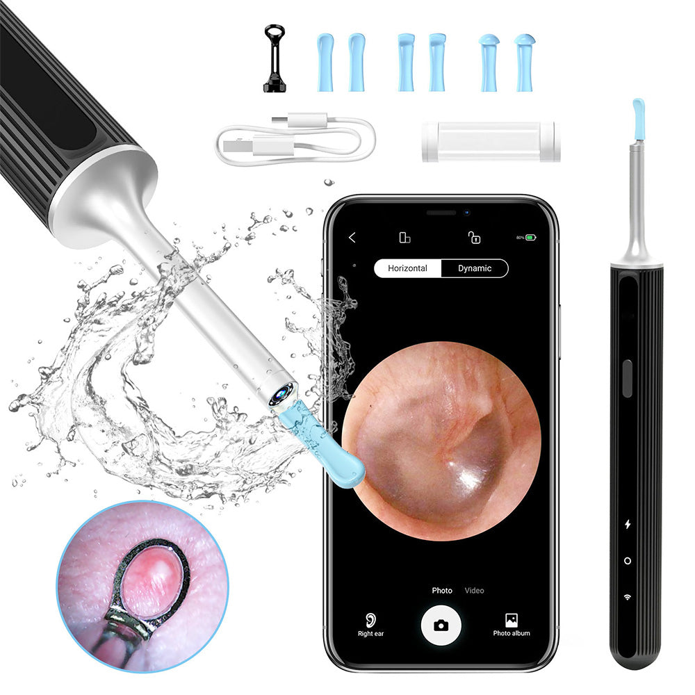 SUNUO X8 Smart Visual Ear Cleaner, Acne Squeezing, 5MP HD Camera, 6-Axis Gyroscope, Silicone Ear Tips, WiFi Connection
