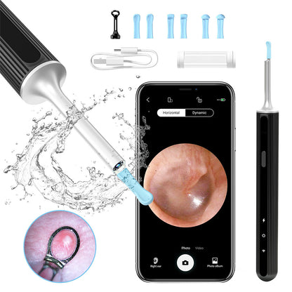 SUNUO X8 Smart Visual Ear Cleaner, Acne Squeezing, 5MP HD Camera, 6-Axis Gyroscope, Silicone Ear Tips, WiFi Connection