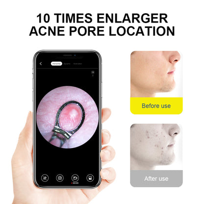 SUNUO X8 Smart Visual Ear Cleaner, Acne Squeezing, 5MP HD Camera, 6-Axis Gyroscope, Silicone Ear Tips, WiFi Connection