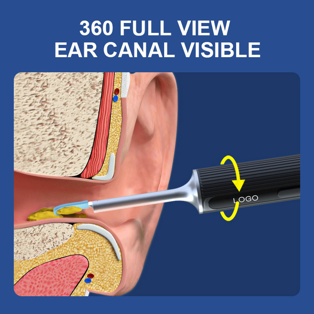 SUNUO X8 Smart Visual Ear Cleaner, Acne Squeezing, 5MP HD Camera, 6-Axis Gyroscope, Silicone Ear Tips, WiFi Connection