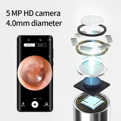 SUNUO X8 Smart Visual Ear Cleaner, Acne Squeezing, 5MP HD Camera, 6-Axis Gyroscope, Silicone Ear Tips, WiFi Connection