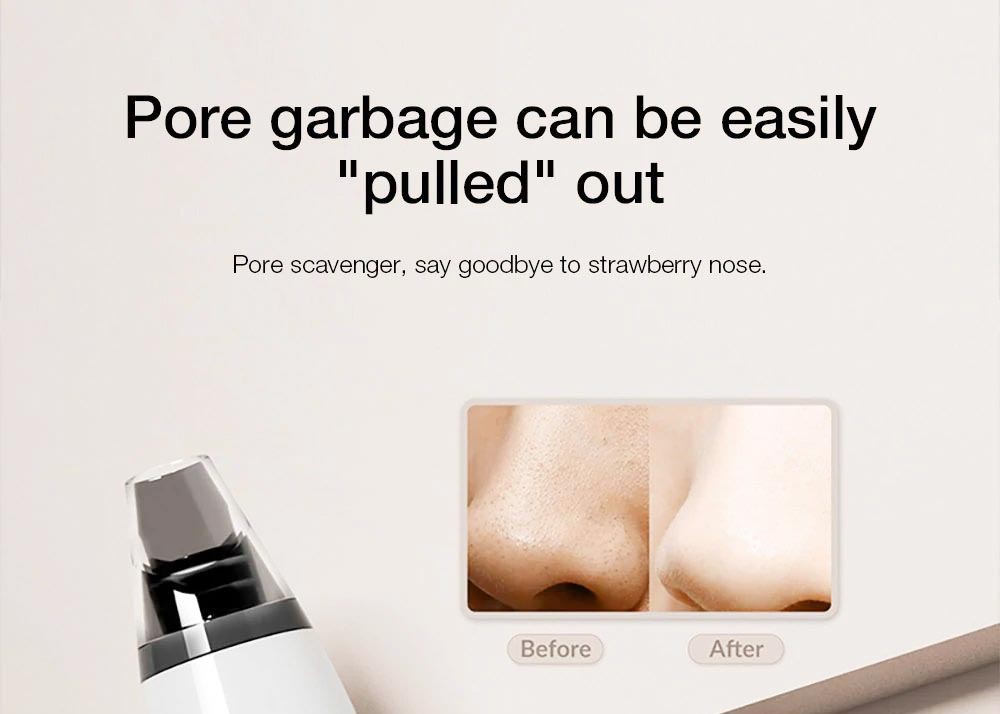 Enchen EB1001 Čistič černých teček Čistič pórů Tři rychlostní stupně Péče o pleť Přístroj na odsávání černých teček Extraktor pórů na obličej