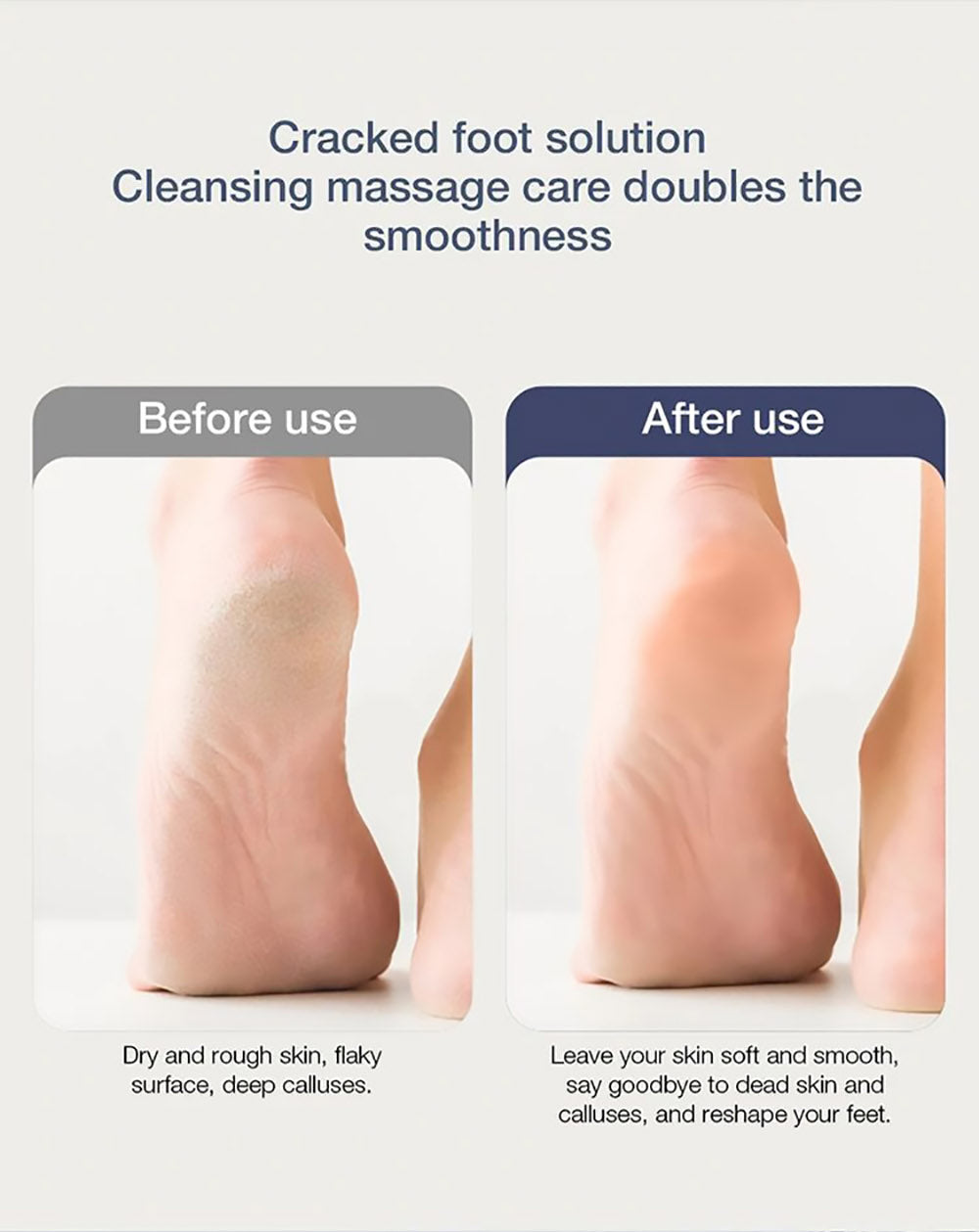 Enchen EMJ001 Elektrická bruska na nohy Odstraňovač strojů 360 stupňů Roll Dvourychlostní nastavení IPX6 Vodotěsná tříbrná brusná hlava