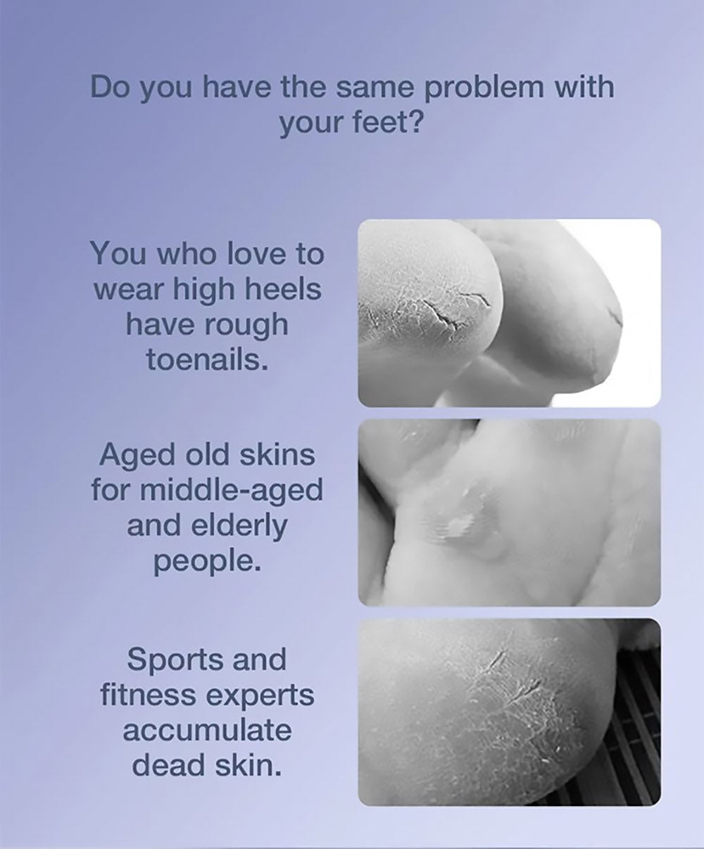 Enchen EMJ001 Elektrická bruska na nohy Odstraňovač strojů 360 stupňů Roll Dvourychlostní nastavení IPX6 Vodotěsná tříbrná brusná hlava