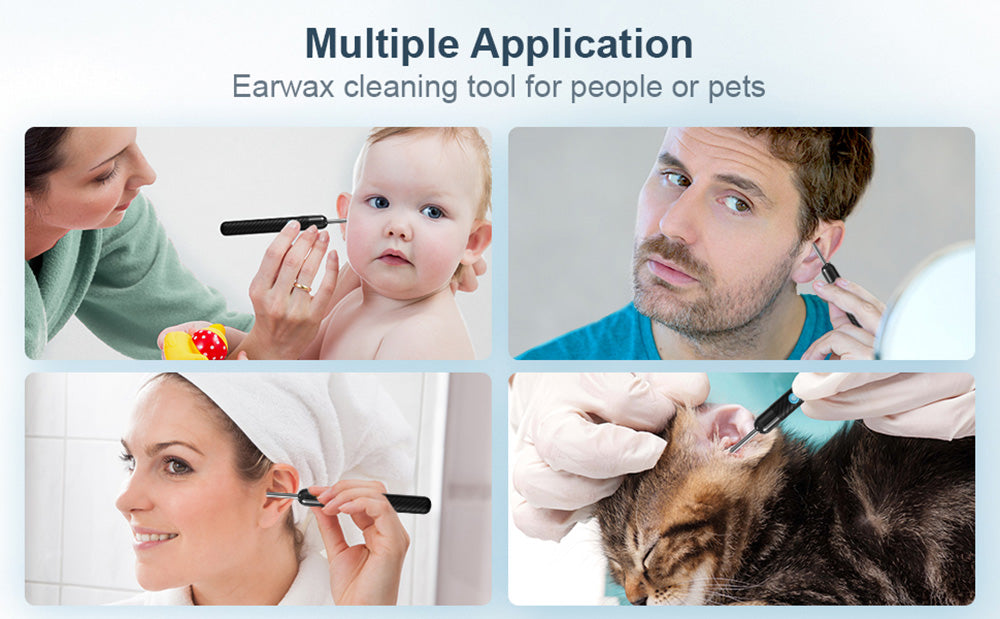 SUNUO X6 Inteligentní vizuální čistič uší Odstraňování ušního mazu, 500W pixelová kamera, silikonové ušní koncovky, 6osý gyroskop, vodotěsnost IP67, WiFi připojení - černá