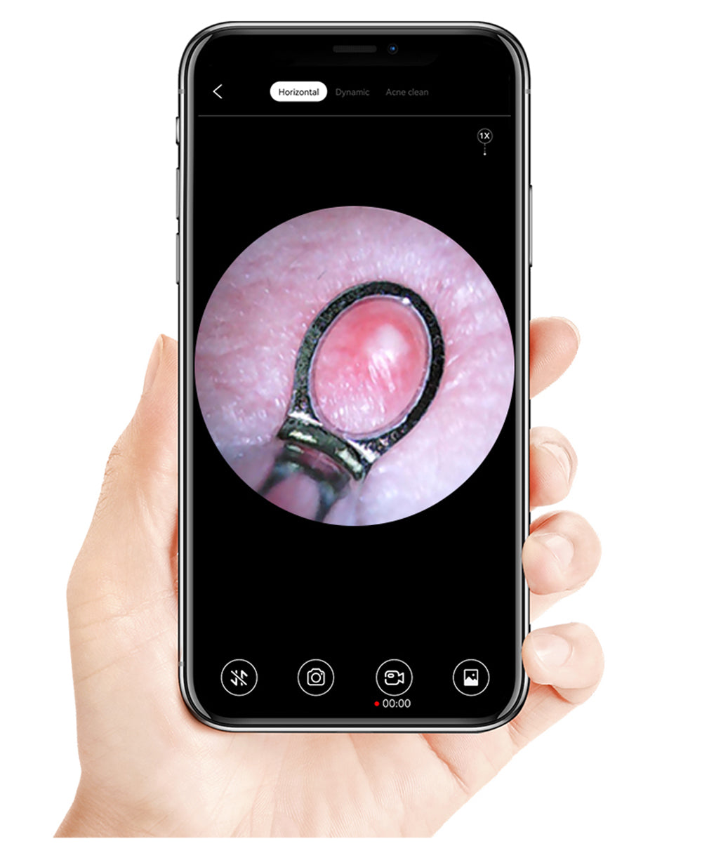 SUNUO X8 Chytrý vizuální čistič uší, odstraňování akné, 5MP HD kamera, 6osý gyroskop, silikonové nástavce do uší, WiFi připojení