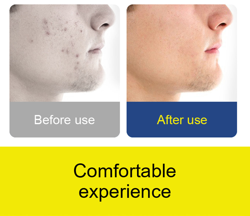 SUNUO X8 Chytrý vizuální čistič uší, odstraňování akné, 5MP HD kamera, 6osý gyroskop, silikonové nástavce do uší, WiFi připojení